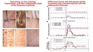 Harvesting, ex vivo culturing,
implantation, and after implantation steps
of the Biopump in patients.
hEPO serum levels and reticulocyte counts
in patients who received implants with the
adenovector Biopump.
 