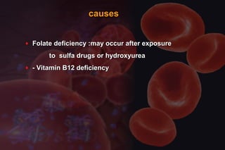 causescauses
♦ Folate deficiency :may occur after exposureFolate deficiency :may occur after exposure
to sulfa drugs or hydroxyureato sulfa drugs or hydroxyurea
♦ - Vitamin B12 deficiency- Vitamin B12 deficiency
 