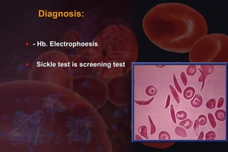 Diagnosis:Diagnosis:
♦ - Hb. Electrophoesis- Hb. Electrophoesis
♦ Sickle test is screening testSickle test is screening test
 
