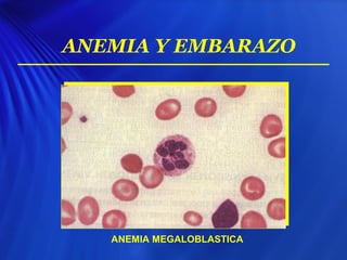 ANEMIA Y EMBARAZO
ANEMIA MEGALOBLASTICA
 