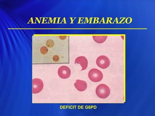 ANEMIA Y EMBARAZO
DEFICIT DE G6PD
 