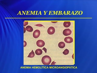 ANEMIA Y EMBARAZO
ANEMIA HEMOLÍTICA MICROANGIOPÁTICA
 