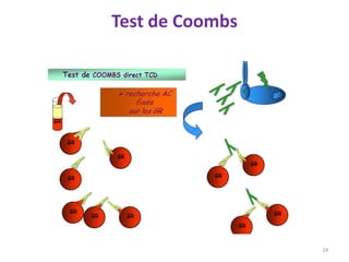 Test de Coombs
24
 