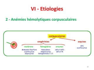 VI - Etiologies
2 - Anémies hémolytiques corpusculaires
28
 