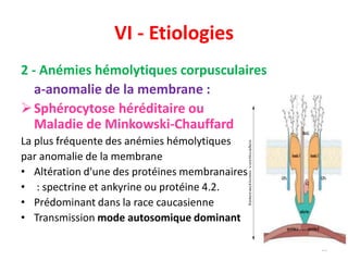 VI - Etiologies
2 - Anémies hémolytiques corpusculaires
a-anomalie de la membrane :
Sphérocytose héréditaire ou
Maladie de Minkowski-Chauffard
La plus fréquente des anémies hémolytiques
par anomalie de la membrane
• Altération d'une des protéines membranaires
• : spectrine et ankyrine ou protéine 4.2.
• Prédominant dans la race caucasienne
• Transmission mode autosomique dominant
30
 