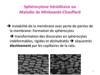 Sphérocytose héréditaire ou
Maladie de Minkowski-Chauffard
 Instabilité de la membrane avec perte de parties de
la membrane: Formation de sphérocytes
 transformation des discocytes en sphérocytes
indéformables, rigides et déshydratés  séquestrés
électivement par les capillaires de la rate.
31
 