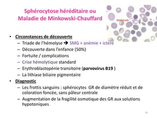 Sphérocytose héréditaire ou
Maladie de Minkowski-Chauffard
• Circonstances de découverte
– Triade de l’hémolyse  SMG + anémie + ictère
– Découverte dans l’enfance (50%)
– Fortuite / complications
– Crise hémolytique standard
– Erythroblastopénie transitoire (parvovirus B19 )
– La lithiase biliaire pigmentaire
• Diagnostic
– Les frottis sanguins : sphérocytes GR de diamètre réduit et de
coloration foncée, sans pâleur centrale
– Augmentation de la fragilité osmotique des GR aux solutions
hypotoniques
33
 