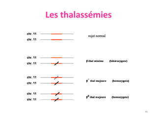 Les thalassémies
46
chromosome 11
 