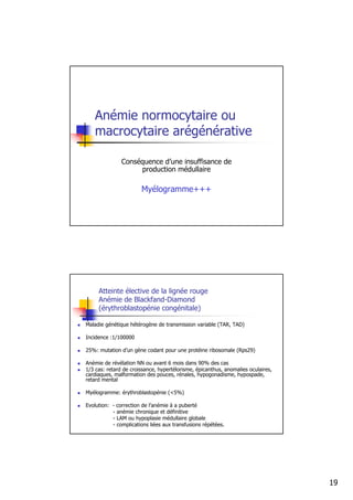 Anémie normocytaire ou
   macrocytaire arégénérative

               Conséquence d’une insuffisance de
                    production médullaire

                       Myélogramme+++




     Atteinte élective de la lignée rouge
     Anémie de Blackfand-Diamond
     (érythroblastopénie congénitale)

Maladie génétique hétérogène de transmission variable (TAR, TAD)

Incidence :1/100000

25%: mutation d’un gène codant pour une protéine ribosomale (Rps29)

Anémie de révélation NN ou avant 6 mois dans 90% des cas
1/3 cas: retard de croissance, hypertélorisme, épicanthus, anomalies oculaires,
cardiaques, malformation des pouces, rénales, hypogonadisme, hypospade,
retard mental

Myélogramme: érythroblastopénie (<5%)

Evolution: - correction de l’anémie à a puberté
           - anémie chronique et définitive
           - LAM ou hypoplasie médullaire globale
           - complications liées aux transfusions répétées.




                                                                                  19
 