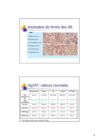 Anomalies de forme des GR




           Hg/HT: valeurs normales
               Nouveau-né         3mois            1an       3-6ans      10-12ans

     GR           5,2+/-1         4+/-0,8        4,4+/-0,8   4,8+/-0,7   4,7+/-0,7
(millions/m
     m3
   Hg           17,2+/-2,5      11,5+/-1,5        12+/-1      13+/-1     13+/-1,5
(g/100ml)
  Ht (%)          54+/-8          38+/-6          39+/-6      40+/-4      41+/-4

VGM (m3)         102+/-10         96+/-5          78+/-8      81+/-8      84+/-7

TCMH (pg)         33+/-4          29+/-5          27+/-4      27+/-3      27+/-3

CCMH (%)          33+/-2          33+/-2          33+/-2      33+/-2      33+/-2


 Taux d’Hg et de GR varie en fonction de l’âge




                                                                                     3
 
