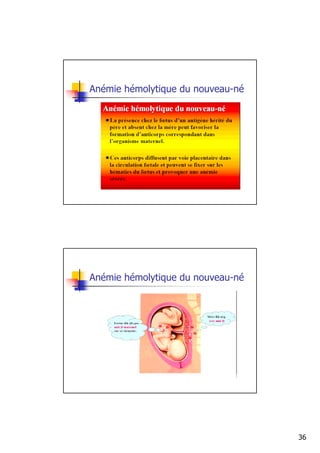 Anémie hémolytique du nouveau-né




Anémie hémolytique du nouveau-né




                                   36
 