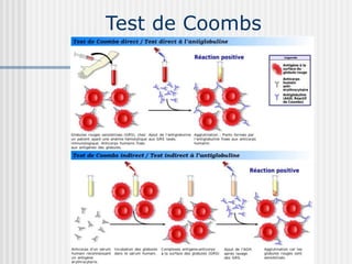 Test de Coombs
 