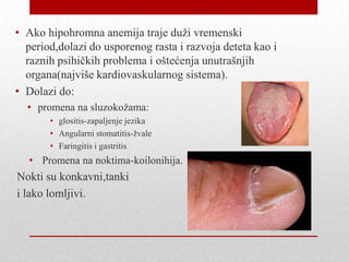 • Ako hipohromna anemija traje duži vremenski
period,dolazi do usporenog rasta i razvoja deteta kao i
raznih psihičkih problema i oštećenja unutrašnjih
organa(najviše kardiovaskularnog sistema).
• Dolazi do:
• promena na sluzokožama:
• glositis-zapaljenje jezika
• Angularni stomatitis-žvale
• Faringitis i gastritis
• Promena na noktima-koilonihija.
Nokti su konkavni,tanki
i lako lomljivi.
 