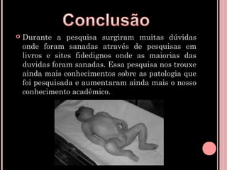    Durante a pesquisa surgiram muitas dúvidas
    onde foram sanadas através de pesquisas em
    livros e sites fidedignos onde as maiorias das
    duvidas foram sanadas. Essa pesquisa nos trouxe
    ainda mais conhecimentos sobre as patologia que
    foi pesquisada e aumentaram ainda mais o nosso
    conhecimento acadêmico.
 