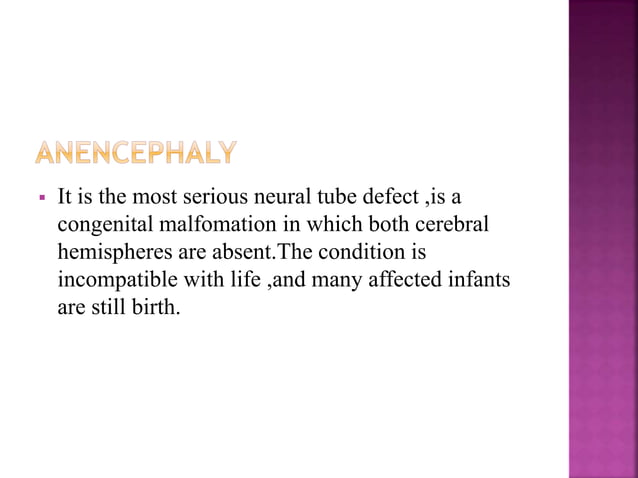 anencephaly.pptx