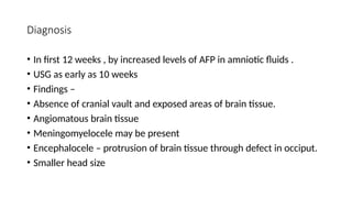 anencephaly.pptx for obstetric and gynac | PPTX