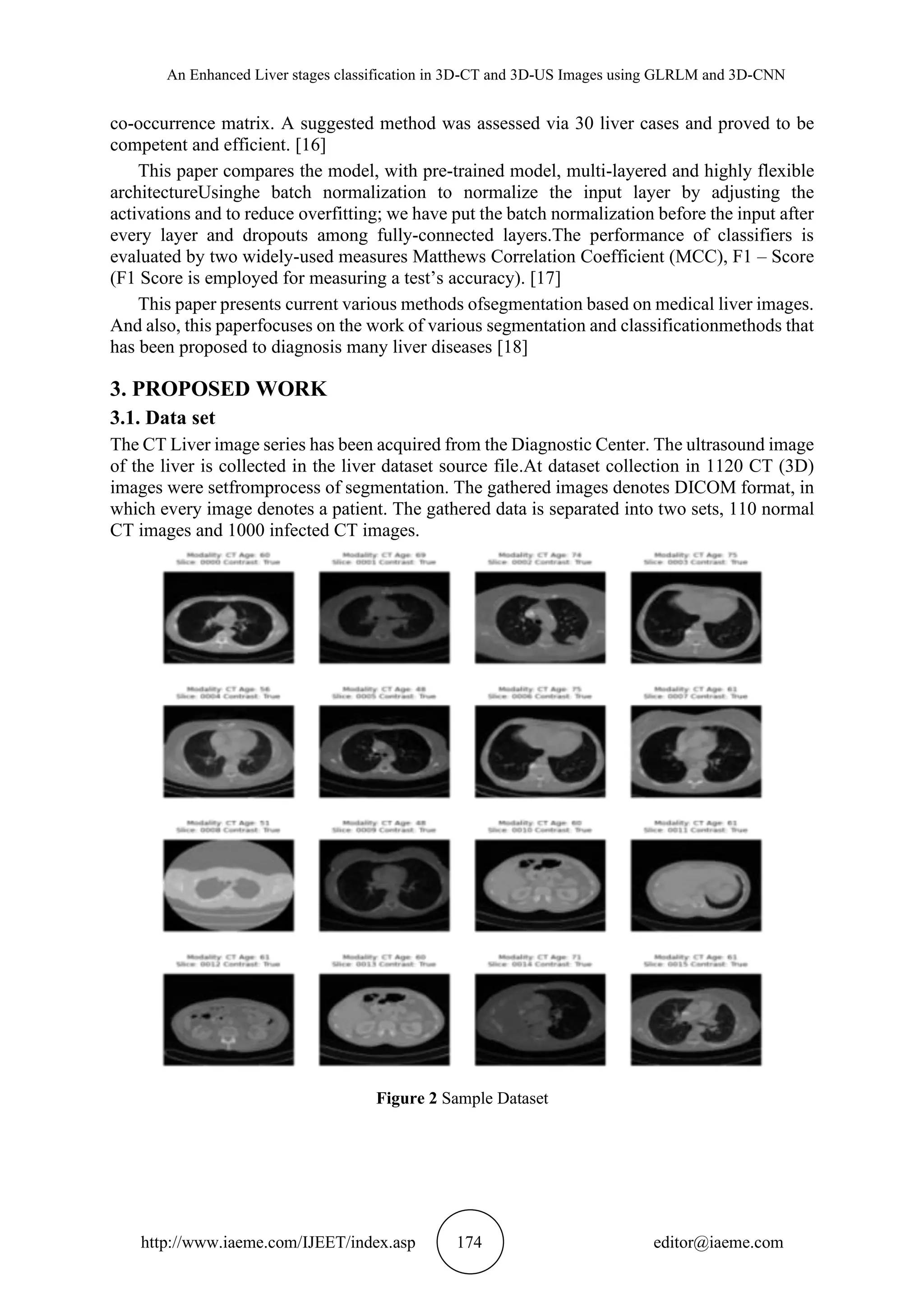 An Enhanced Liver stages classification in 3D-CT and 3D-US Images using GLRLM and 3D-CNN
http://www.iaeme.com/IJEET/index.asp 174 editor@iaeme.com
co-occurrence matrix. A suggested method was assessed via 30 liver cases and proved to be
competent and efficient. [16]
This paper compares the model, with pre-trained model, multi-layered and highly flexible
architectureUsinghe batch normalization to normalize the input layer by adjusting the
activations and to reduce overfitting; we have put the batch normalization before the input after
every layer and dropouts among fully-connected layers.The performance of classifiers is
evaluated by two widely-used measures Matthews Correlation Coefficient (MCC), F1 – Score
(F1 Score is employed for measuring a test’s accuracy). [17]
This paper presents current various methods ofsegmentation based on medical liver images.
And also, this paperfocuses on the work of various segmentation and classificationmethods that
has been proposed to diagnosis many liver diseases [18]
3. PROPOSED WORK
3.1. Data set
The CT Liver image series has been acquired from the Diagnostic Center. The ultrasound image
of the liver is collected in the liver dataset source file.At dataset collection in 1120 CT (3D)
images were setfromprocess of segmentation. The gathered images denotes DICOM format, in
which every image denotes a patient. The gathered data is separated into two sets, 110 normal
CT images and 1000 infected CT images.
Figure 2 Sample Dataset
 