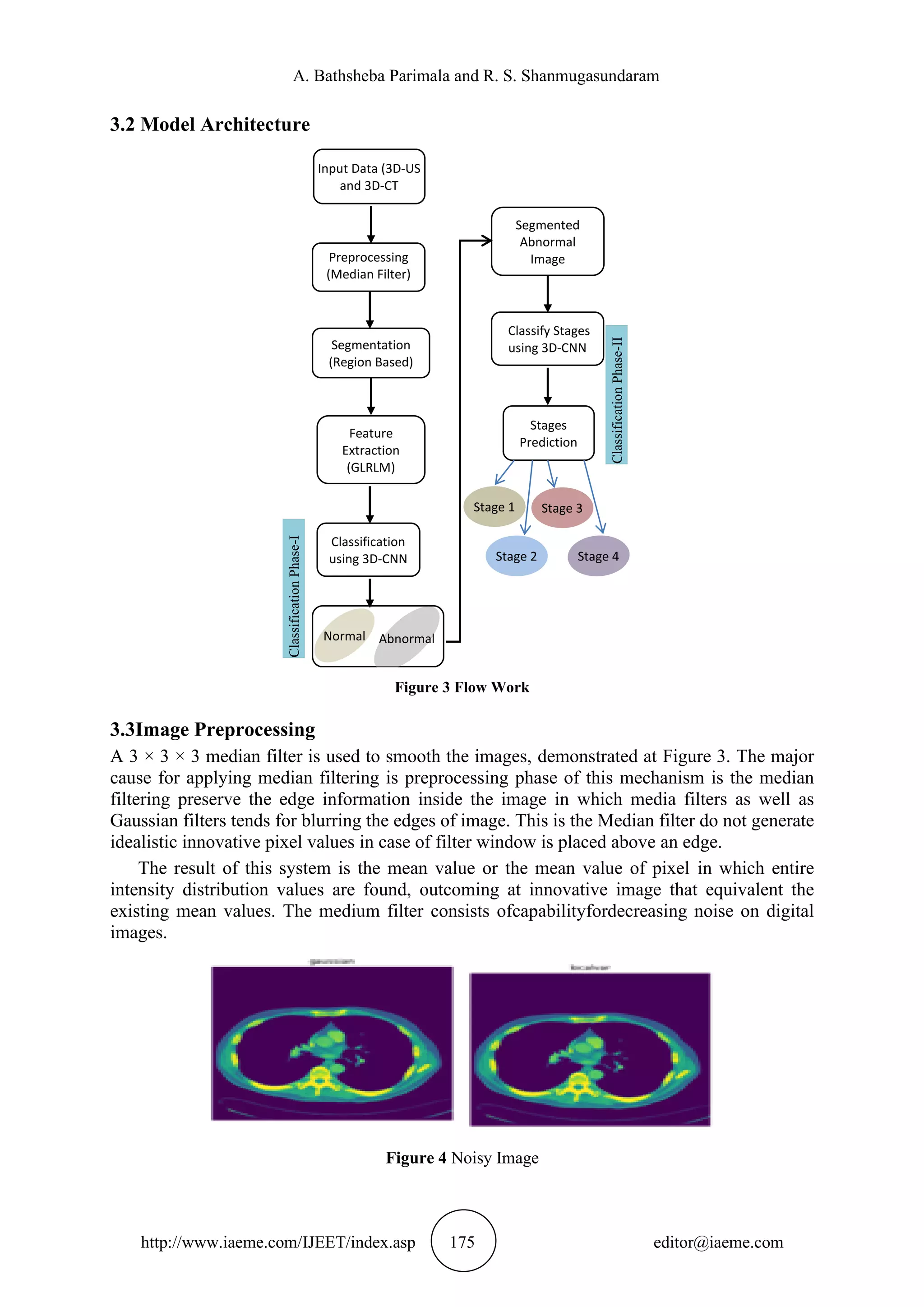 A. Bathsheba Parimala and R. S. Shanmugasundaram
http://www.iaeme.com/IJEET/index.asp 175 editor@iaeme.com
3.2 Model Architecture
Figure 3 Flow Work
3.3Image Preprocessing
A 3 × 3 × 3 median filter is used to smooth the images, demonstrated at Figure 3. The major
cause for applying median filtering is preprocessing phase of this mechanism is the median
filtering preserve the edge information inside the image in which media filters as well as
Gaussian filters tends for blurring the edges of image. This is the Median filter do not generate
idealistic innovative pixel values in case of filter window is placed above an edge.
The result of this system is the mean value or the mean value of pixel in which entire
intensity distribution values are found, outcoming at innovative image that equivalent the
existing mean values. The medium filter consists ofcapabilityfordecreasing noise on digital
images.
Figure 4 Noisy Image
Input Data (3D-US
and 3D-CT
Preprocessing
(Median Filter)
Segmentation
(Region Based)
Feature
Extraction
(GLRLM)
Classification
using 3D-CNN
Segmented
Abnormal
Image
Abnormal
Normal
Classify Stages
using 3D-CNN
Stages
Prediction
Stage 1
Stage 2
Stage 3
Stage 4
Classification
Phase-I
Classification
Phase-II
 