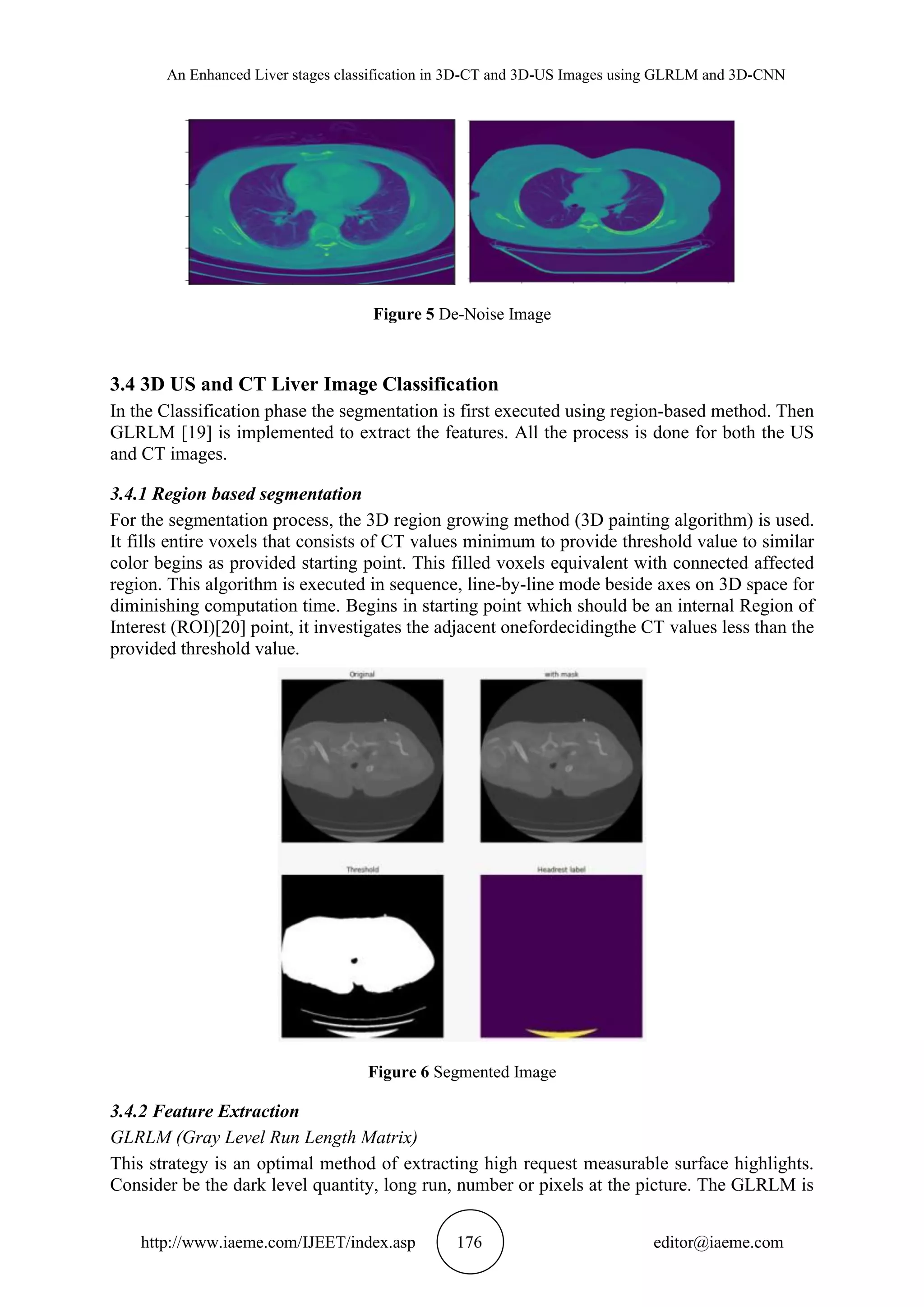 An Enhanced Liver stages classification in 3D-CT and 3D-US Images using GLRLM and 3D-CNN
http://www.iaeme.com/IJEET/index.asp 176 editor@iaeme.com
Figure 5 De-Noise Image
3.4 3D US and CT Liver Image Classification
In the Classification phase the segmentation is first executed using region-based method. Then
GLRLM [19] is implemented to extract the features. All the process is done for both the US
and CT images.
3.4.1 Region based segmentation
For the segmentation process, the 3D region growing method (3D painting algorithm) is used.
It fills entire voxels that consists of CT values minimum to provide threshold value to similar
color begins as provided starting point. This filled voxels equivalent with connected affected
region. This algorithm is executed in sequence, line-by-line mode beside axes on 3D space for
diminishing computation time. Begins in starting point which should be an internal Region of
Interest (ROI)[20] point, it investigates the adjacent onefordecidingthe CT values less than the
provided threshold value.
Figure 6 Segmented Image
3.4.2 Feature Extraction
GLRLM (Gray Level Run Length Matrix)
This strategy is an optimal method of extracting high request measurable surface highlights.
Consider be the dark level quantity, long run, number or pixels at the picture. The GLRLM is
 