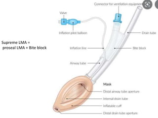 Supreme LMA =
proseal LMA + Bite block
 