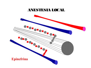ANESTESIA LOCAL
Epinefrina
 