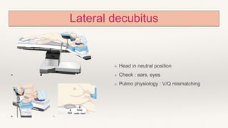 Lateral decubitus
❖ Head in neutral position
❖ Check : ears, eyes
❖ Pulmo physiology : V/Q mismatching
 