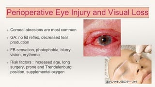 Perioperative Eye Injury and Visual Loss
❖ Corneal abrasions are most common
❖ GA: no lid reflex, decreased tear
production
❖ FB sensation, photophobia, blurry
vision, erythema
❖ Risk factors : increased age, long
surgery, prone and Trendelenburg
position, supplemental oxygen
 