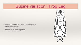 Supine variation : Frog Leg
❖ Hips and knees flexed and the hips are
externally rotated
❖ Knees must be supported
 