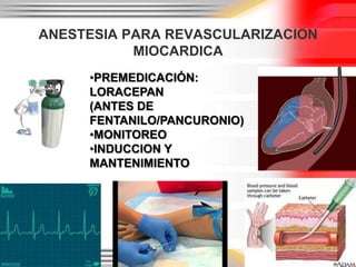 ANESTESIA PARA REVASCULARIZACION
           MIOCARDICA
     •PREMEDICACIÓN:
     LORACEPAN
     (ANTES DE
     FENTANILO/PANCURONIO)
     •MONITOREO
     •INDUCCION Y
     MANTENIMIENTO
 