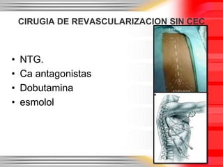 CIRUGIA DE REVASCULARIZACION SIN CEC



•   NTG.
•   Ca antagonistas
•   Dobutamina
•   esmolol
 