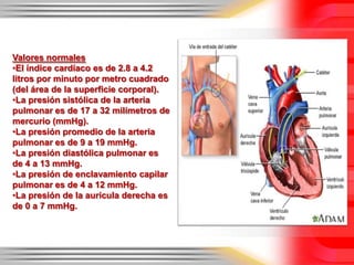 Valores normales
•El índice cardíaco es de 2.8 a 4.2
litros por minuto por metro cuadrado
(del área de la superficie corporal).
•La presión sistólica de la arteria
pulmonar es de 17 a 32 milímetros de
mercurio (mmHg).
•La presión promedio de la arteria
pulmonar es de 9 a 19 mmHg.
•La presión diastólica pulmonar es
de 4 a 13 mmHg.
•La presión de enclavamiento capilar
pulmonar es de 4 a 12 mmHg.
•La presión de la aurícula derecha es
de 0 a 7 mmHg.
 