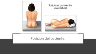 Posicion del paciente.
 