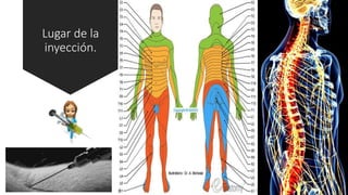 Lugar de la
inyección.
 