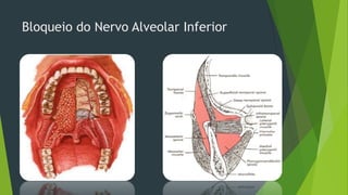 Bloqueio do Nervo Alveolar Inferior

 