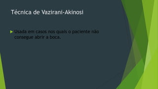 Técnica de Vazirani-Akinosi


Usada em casos nos quais o paciente não
consegue abrir a boca.

 