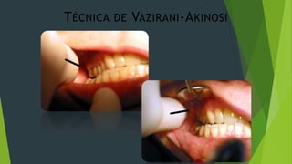 T ÉCNICA

DE

VAZIRANI -A KINOSI

 