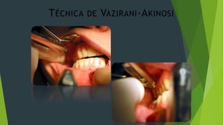 T ÉCNICA

DE

VAZIRANI -A KINOSI

 