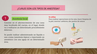 ¿CUÁLES SON LOS TIPOS DE ANESTESIA?
Anestesia local
Consiste en el adormecimiento de una zona
muy localizada del cuerpo, en el lugar donde
va a realizarse un determinado procedimiento
doloroso.
Se puede realizar administrando un líquido o
una crema (anestesia tópica) o inyectando un
anestésico con una aguja en un determinado
área.
1
Se utiliza
Para realizar operaciones en los ojos, hacer biopsias de
la piel, insertar catéteres, dar puntos de sutura
 