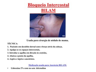 Bloqueio Intercostal
BILAM
Usada para cirurgia de nódulo de mama.
TÉCNICA:
1. Paciente em decubito dorsal com o braço atrás da cabeça,
2. Apalpa-se os espaços intercostais,
3. Introduz a agulha em direção às costelas,
4. Abaixa a ponta da agulha,
4. Aspira e injeta o anestésico.
Medicação usada para Anestesia BILAM:
• Lidocaina 2% com ou sem Adrenalina
 