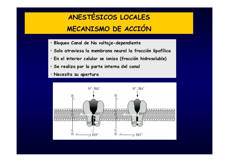 Anestesia Local