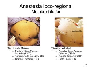 25
Anestesia loco-regional
Membro inferior
Técnica de Mansur
– Espinha Ilíaca Postero
Superior (EIPS)
– Tuberosidade Isquiática (TI)
– Grande Trocânter (GT)
Técnica de Labat
– Espinha Ilíaca Postero
Superior (EIPS)
– Grande Trocânter (GT)
– Hiato Sacral (HS)
ponto médio
 