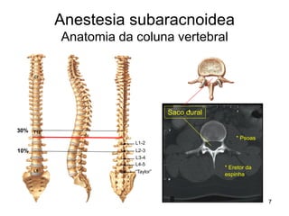 7
Anestesia subaracnoidea
Anatomia da coluna vertebral
* Psoas
* Eretor da
espinha
Saco dural
30%
10%
“Taylor”
L4-5
L3-4
L2-3
L1-2
L5
T12
C7
 