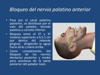 Bloqueo del nervio palatino anterior Pasa por el canal palatino posterior, se distribuye por el velo del paladar, bóveda palatina y cornete inferior.  Bloquea entre el 2º y 3º molares superiores a 0,5-1  cm por dentro del reborde gingival,  dirigiendo  la aguja hacia atrás y hacia arriba Como complemento del bloqueo de los nervios dentarios posterior y medio  para anestesia de la parte posterior del paladar óseo. 