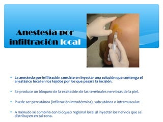 • La anestesia por infiltración consiste en inyectar una solución que contenga el
anestésico local en los tejidos por los que pasara la incisión.
• Se produce un bloqueo de la excitación de las terminales nerviosas de la piel.
• Puede ser percutánea (infiltración intradérmica), subcutánea o intramuscular.
• A menudo se combina con bloqueo regional local al inyectar los nervios que se
distribuyen en tal zona.
Anestesia por
infiltración local
 