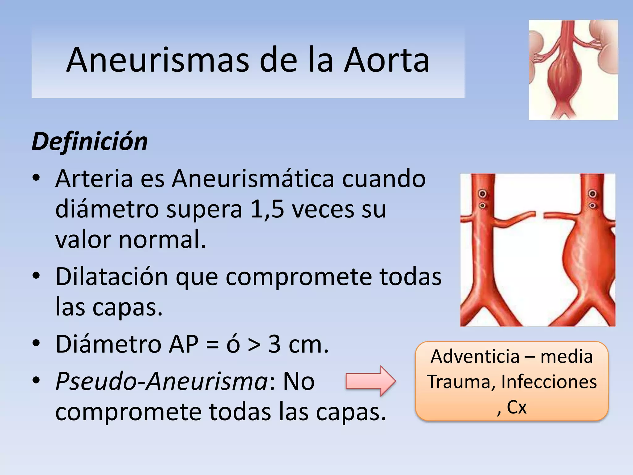 Anestesia aneurisma de aorta abdominal | PPTX