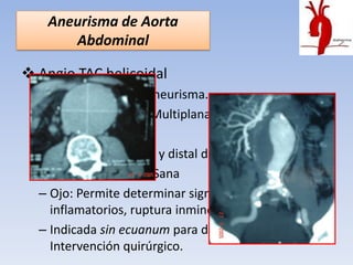Aneurisma de Aorta
       Abdominal

 Angio TAC helicoidal
  – Dimensiones del Aneurisma.
  – Reconstrucciones Multiplanares.
  – “Estándar de Oro”
  – Extensión proximal y distal de AA.
  – Longitud de Aorta Sana
  – Ojo: Permite determinar signos
    inflamatorios, ruptura inminente.
  – Indicada sin ecuanum para determinar tipo de
    Intervención quirúrgico.
 
