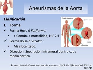 Aneurismas de la Aorta
Clasificación
I. Forma
 Forma Huso ó Fusiforme:
 • > Común, > mortalidad, H:F 2:1
 Forma Bolsa ó Secular :
 • Mas localizado.
 Disección: Separación Intramural dentro capa
  media aortica.

    Seminars in Cardiothoracic and Vascular Anesthesia, Vol 9, No 3 (September), 2005: pp
                                                                                 227–240
 