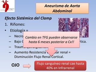 Aneurisma de Aorta
                             Abdominal
Efecto Sistémico del Clamp
1. Riñones:
• Etiología =
  –    Necrosis Tubular Aguda.
              Cambio en TFG pueden observarse
  –    Bajo GC, Émbolosmeses posterior a Cx!! aortica.
                hasta 6 de placa ateromatosa
  –    Trauma quirúrgico renal.
  –    Aumento Resistencia vascular renal =
       Disminución Flujo Renal Cortical.

      OJO            Flujo sanguíneo renal cae hasta
                            40% en Infrarrenal
 