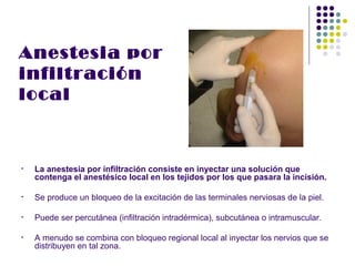 Anestesia por
infiltración
local



•   La anestesia por infiltración consiste en inyectar una solución que
    contenga el anestésico local en los tejidos por los que pasara la incisión.

•   Se produce un bloqueo de la excitación de las terminales nerviosas de la piel.

•   Puede ser percutánea (infiltración intradérmica), subcutánea o intramuscular.

•   A menudo se combina con bloqueo regional local al inyectar los nervios que se
    distribuyen en tal zona.
 