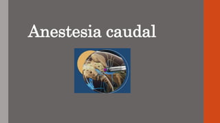 Anestesia caudal
 
